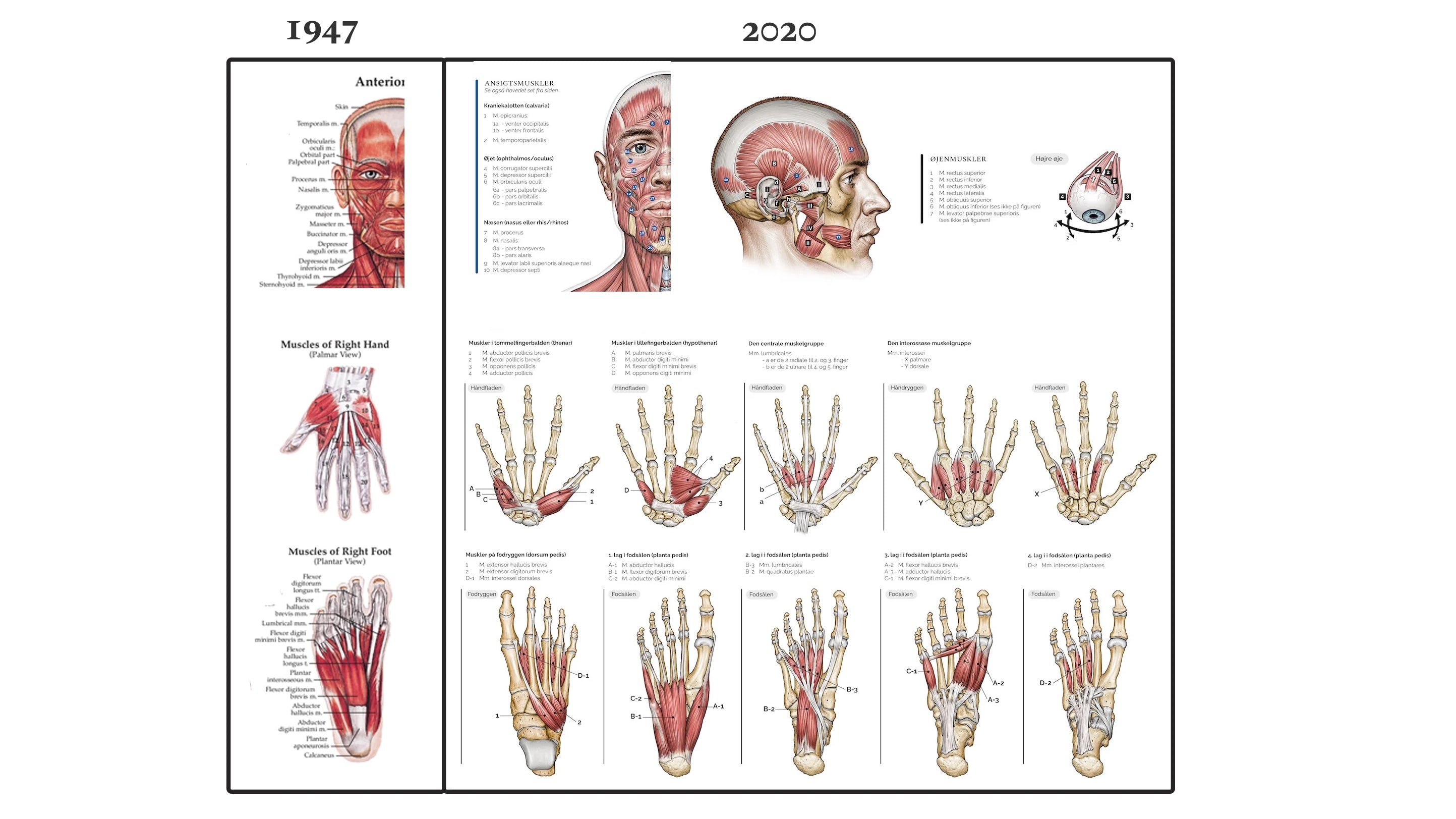 Den klassiske muskelplakat er genskabt og designet i Danmark - eAnatomi