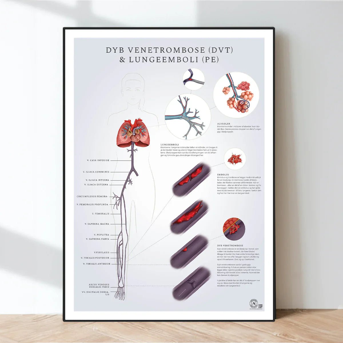 Patologiske tilstande - eAnatomi