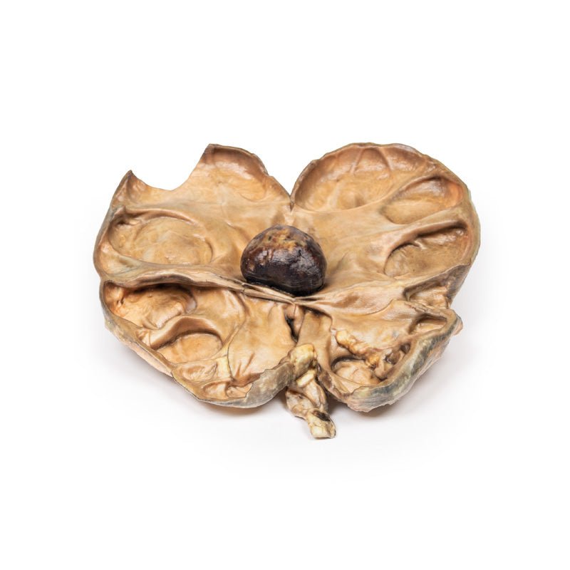 Patologiske tilstande - eAnatomi