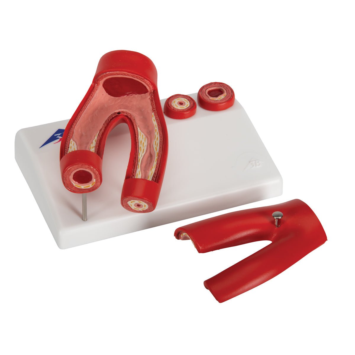 Patologiske tilstande modeller - eAnatomi