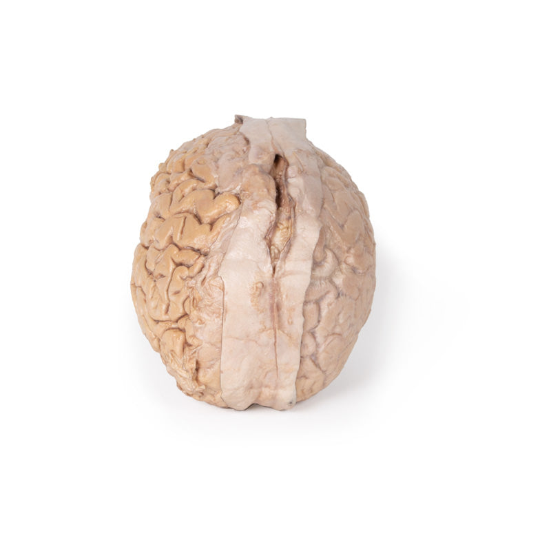 Hjerne (Cerebrum)