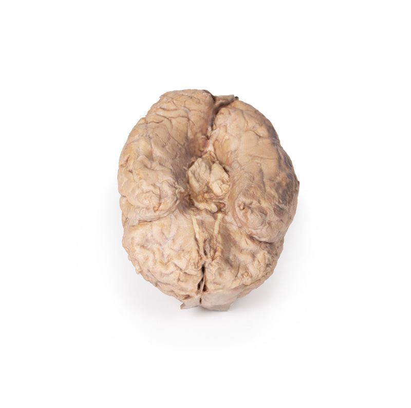 Hjerne (Cerebrum)