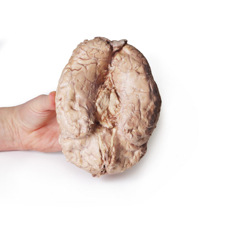 Hjerne (Cerebrum)