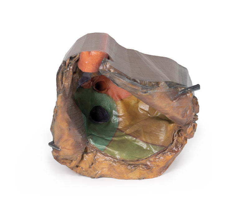 Perikardiet