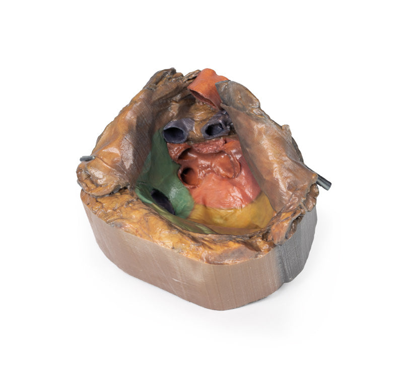 Perikardiet