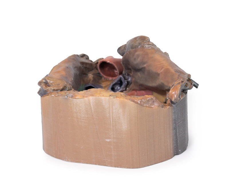 Perikardiet