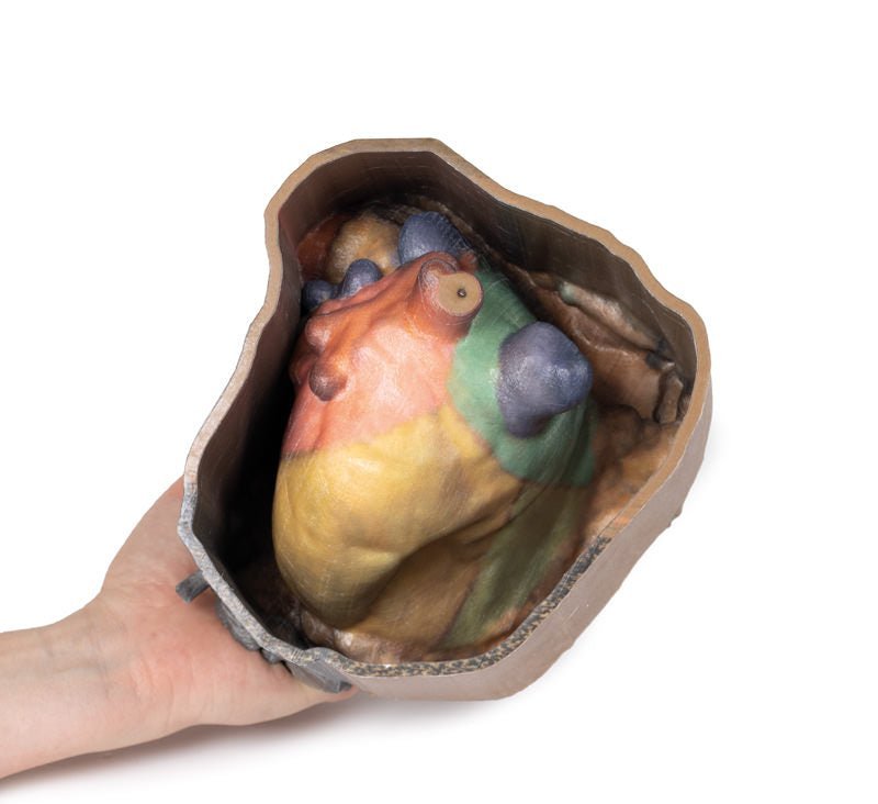 Perikardiehulen - eAnatomi