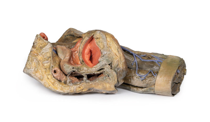 Del af Kvindens pelvis og lår