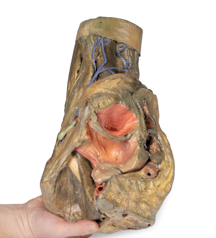 Del af Kvindens pelvis og lår