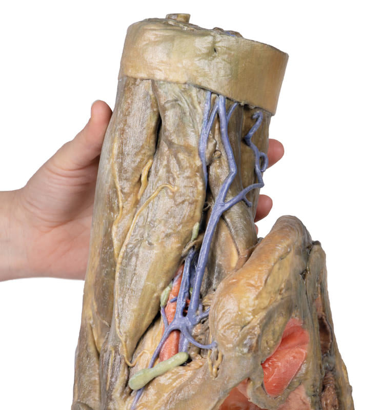 Del af Kvindens pelvis og lår