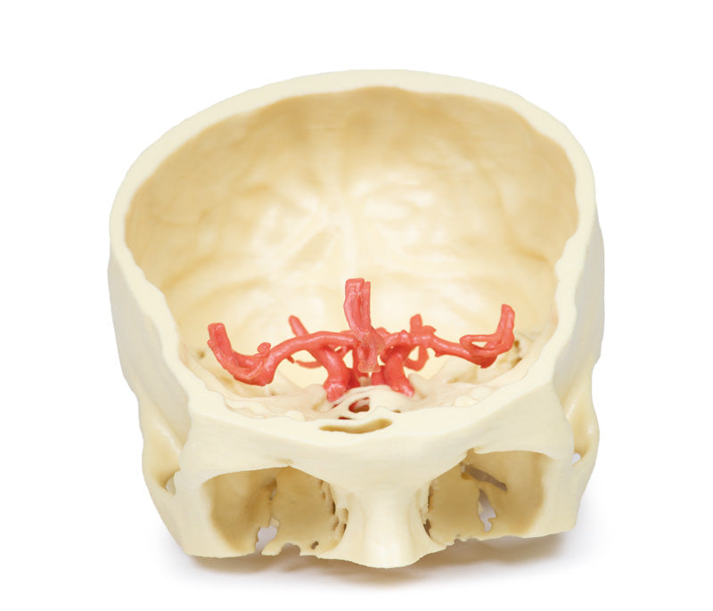 Circle of Willis