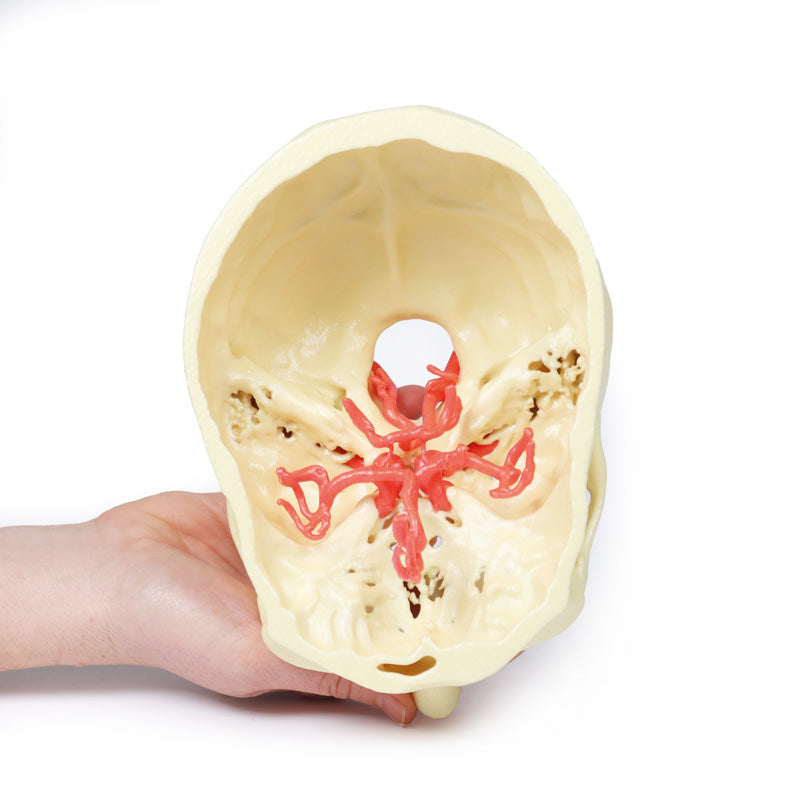 Circle of Willis