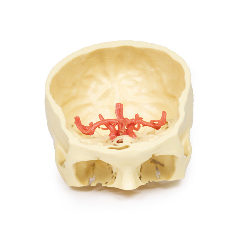 Circle of Willis