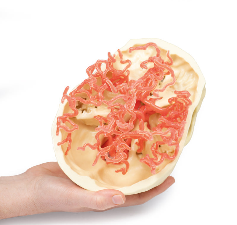 Arteriel cirkulation