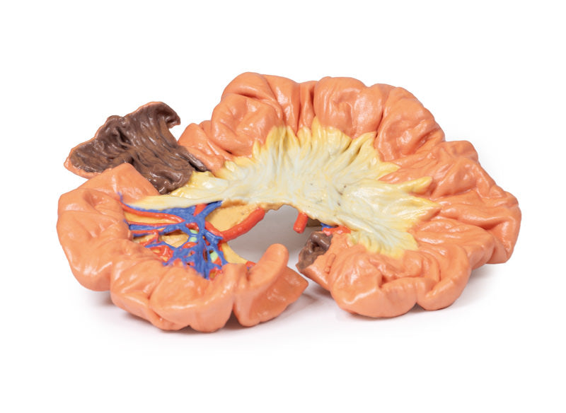 Tarm - Del af Ileum