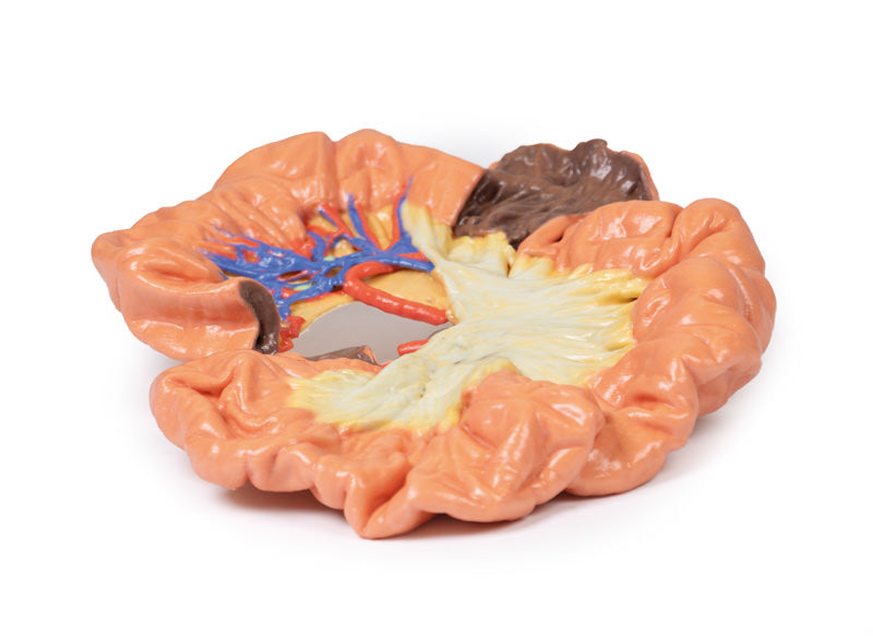 Tarm - Del af Ileum