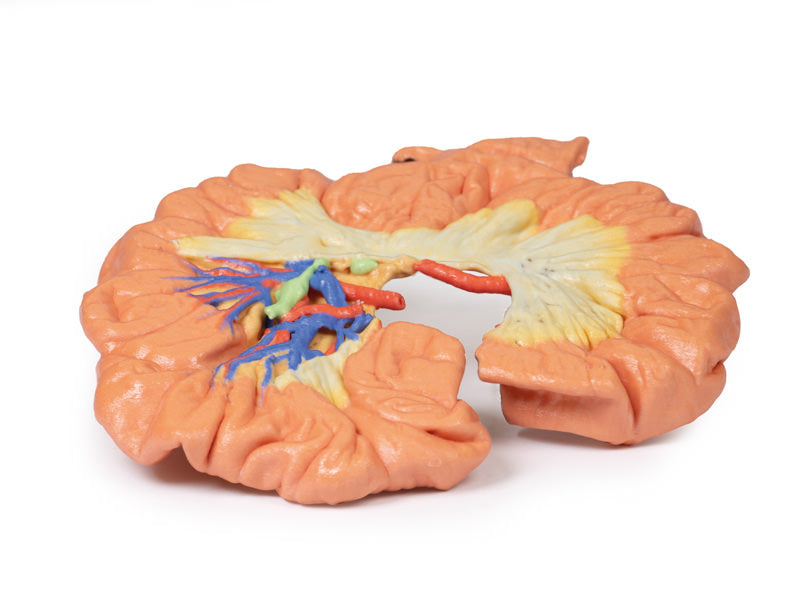 Tarm - Del af Ileum