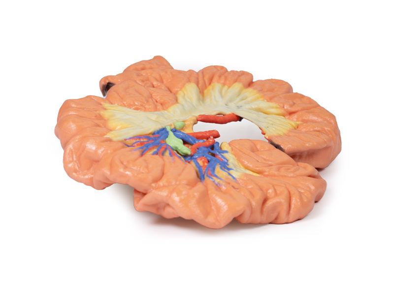Tarm - Del af Ileum