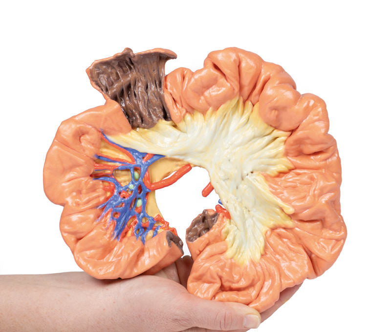 Tarm - Del af Ileum