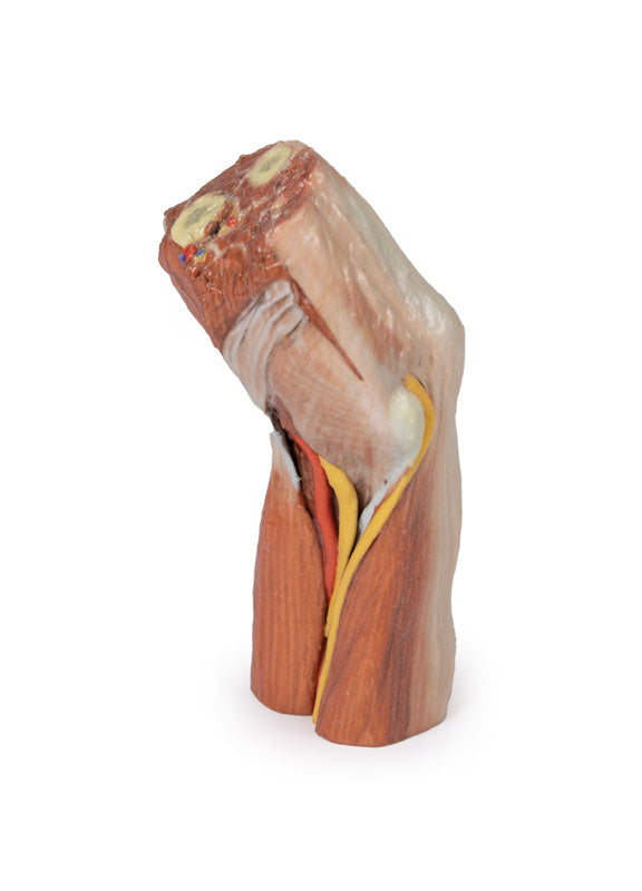 Cubital fossa - muskler, store nerver og brachialis arterie