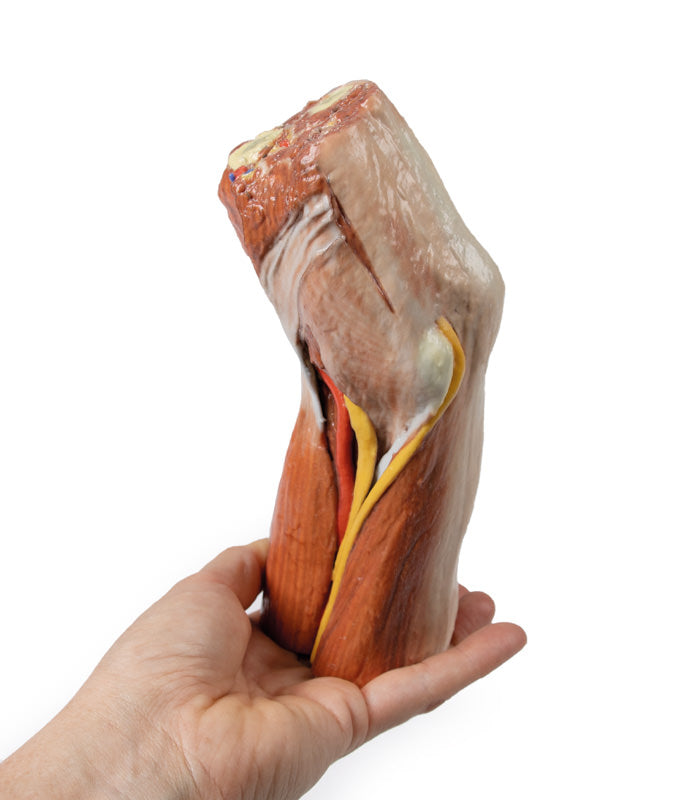 Cubital fossa - muskler, store nerver og brachialis arterie