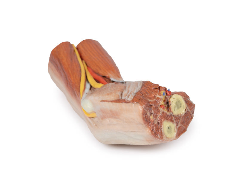 Cubital fossa - muskler, store nerver og brachialis arterie