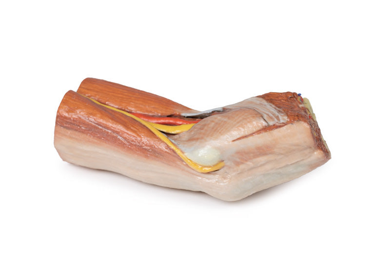 Cubital fossa - muskler, store nerver og brachialis arterie