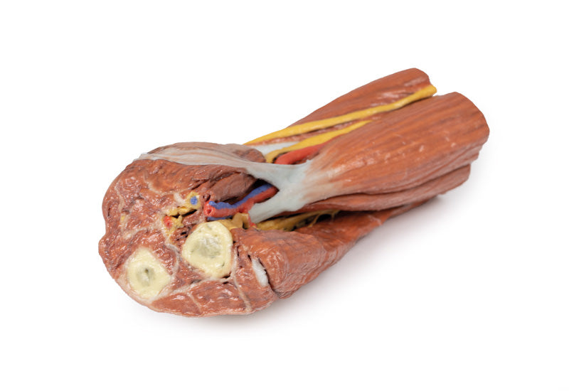 Cubital fossa - muskler, store nerver og brachialis arterie