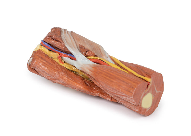 Cubital fossa - muskler, store nerver og brachialis arterie