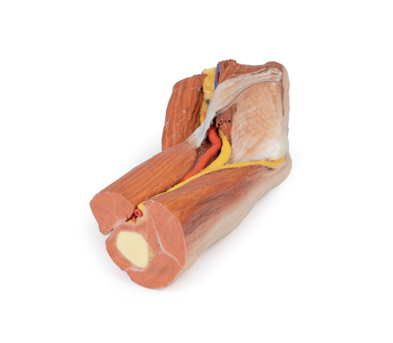 Cubital fossa - muskler, store nerver og brachialis arterie