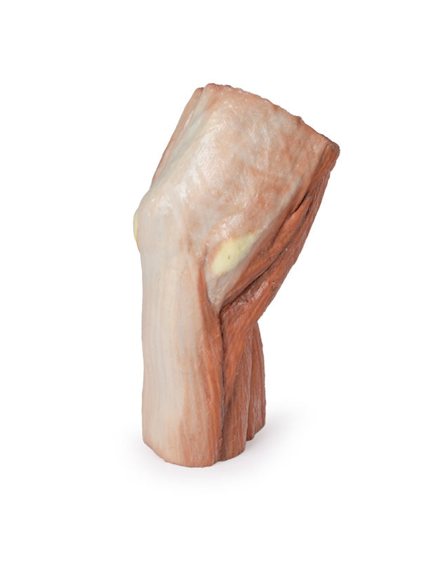 Cubital fossa - muskler, store nerver og brachialis arterie