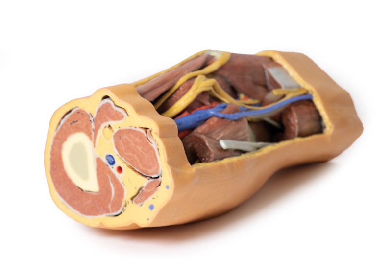 Popliteal Fossa distalt lår og proksimalt ben