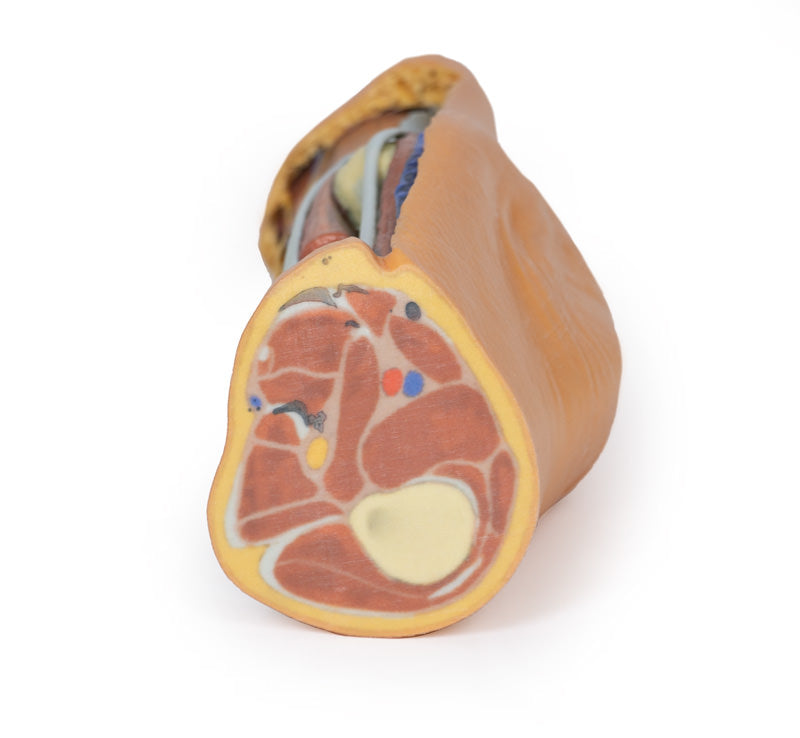 Popliteal Fossa