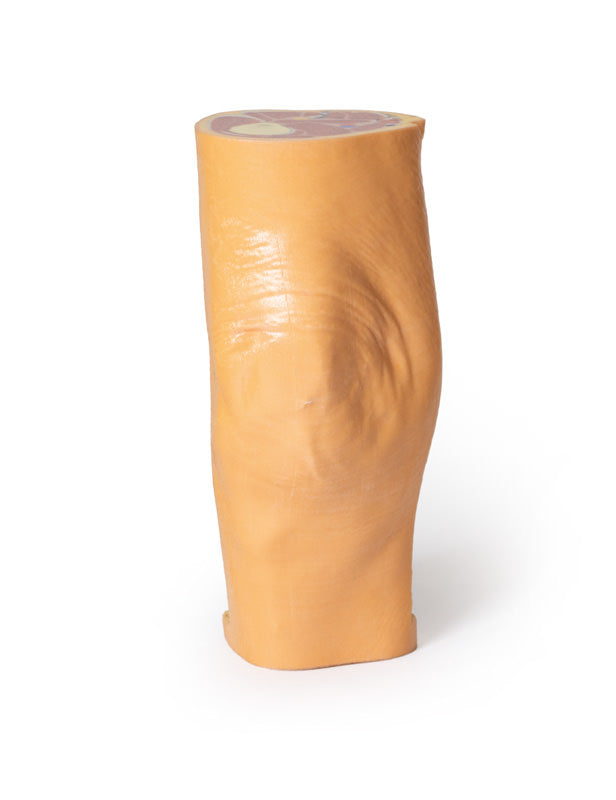 Popliteal Fossa