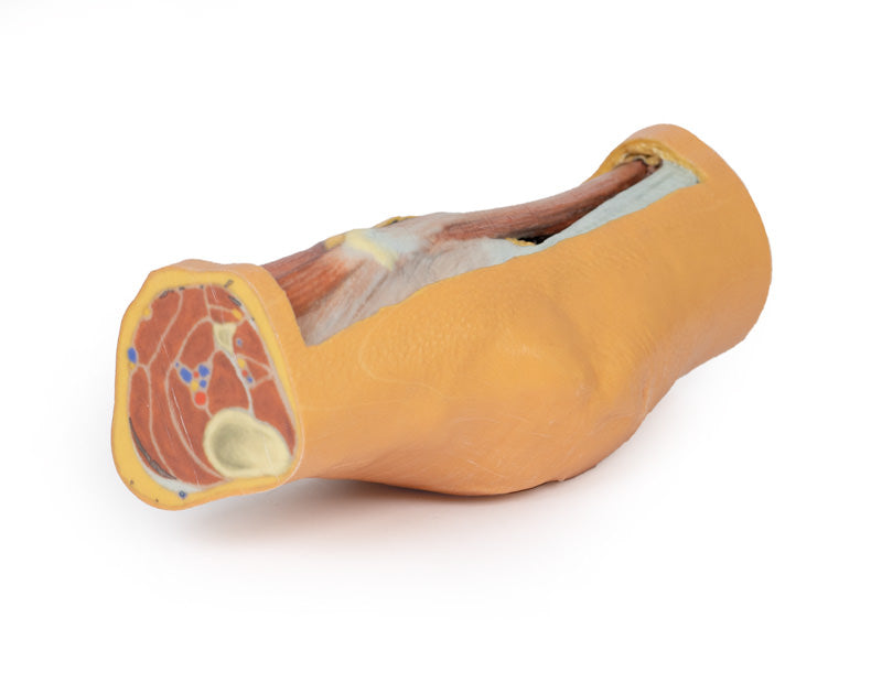 Popliteal Fossa