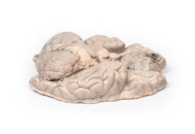 Meningiom