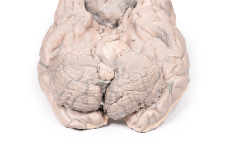 Meningiom