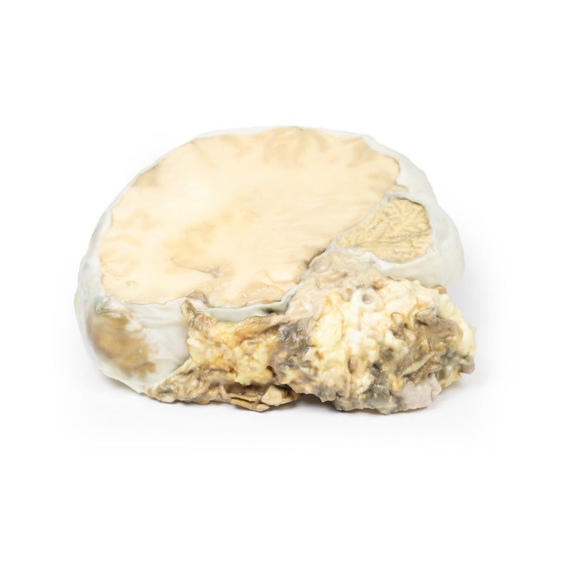 Hypofyse adenom