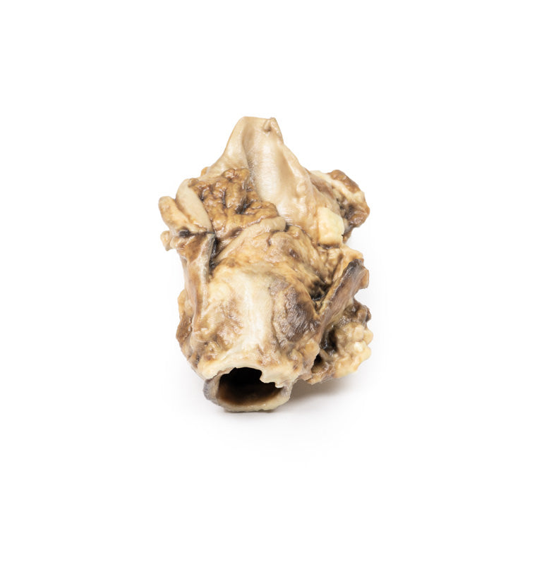 Karcinom af Pyriform Fossa