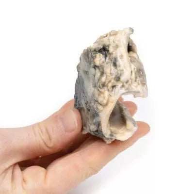Carcinom i Larynx