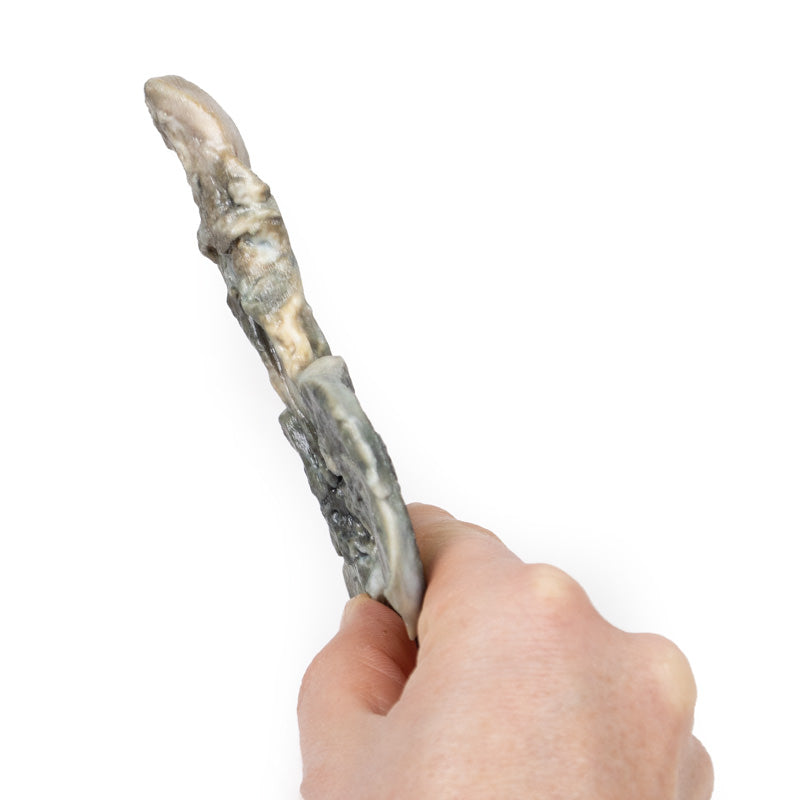 Tracheoesophageal fistel og esophagus atresia