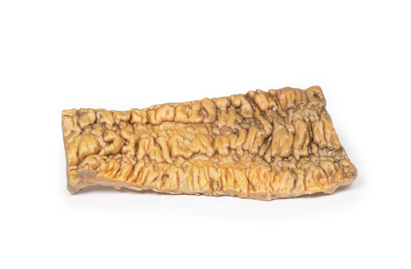 Colitis ulcerosa