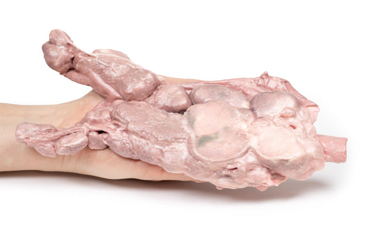 Aorta og para-aorta lymfeknuder