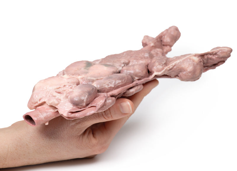Aorta og para-aorta lymfeknuder