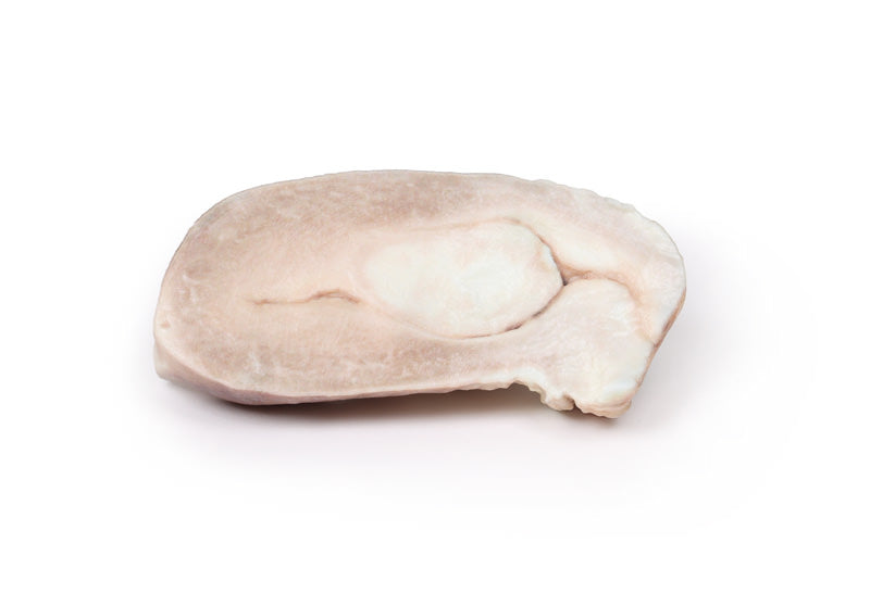 Uterin leiomyom