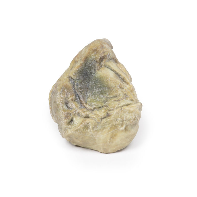 Hydrocoele