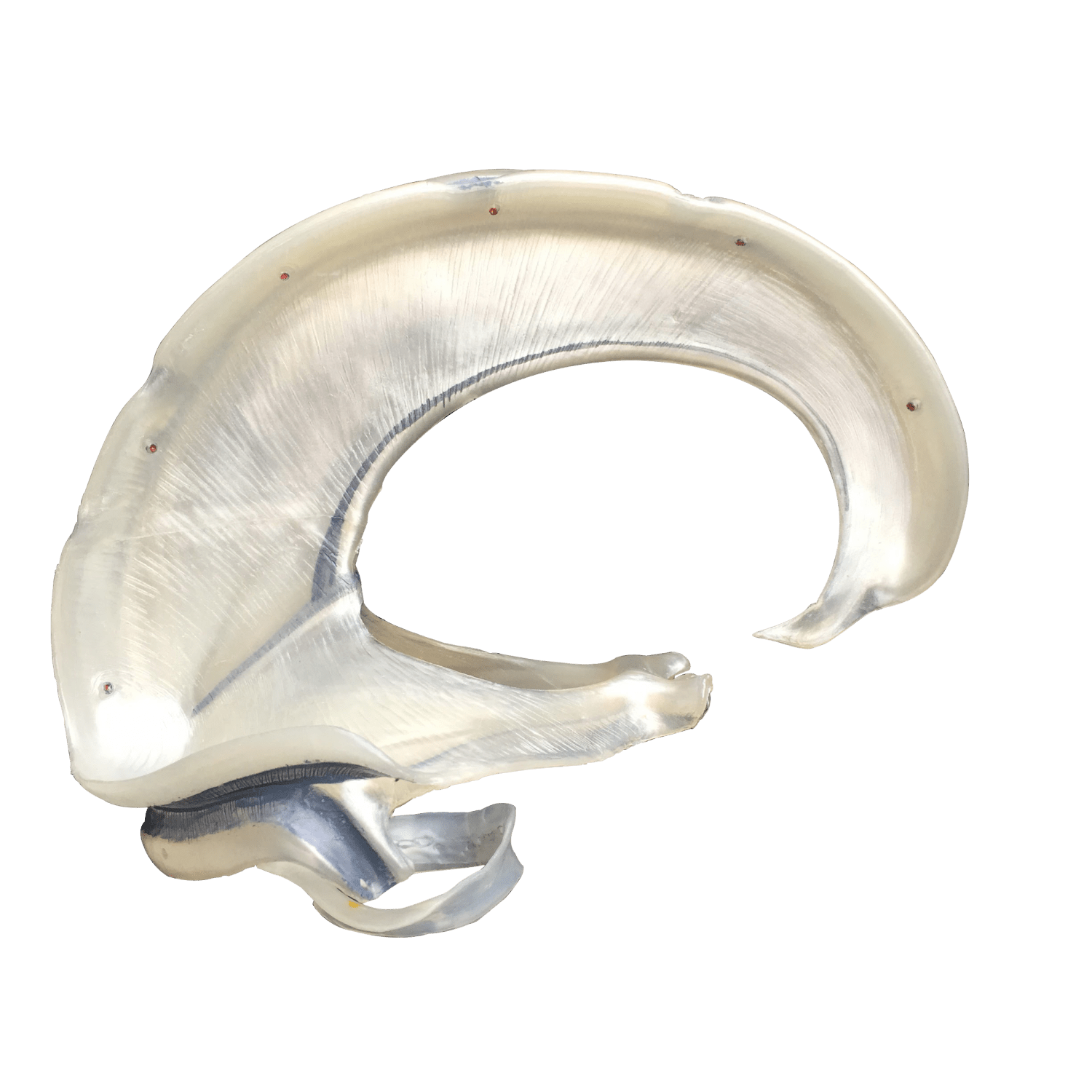 Udsnit af dura mater - eAnatomi