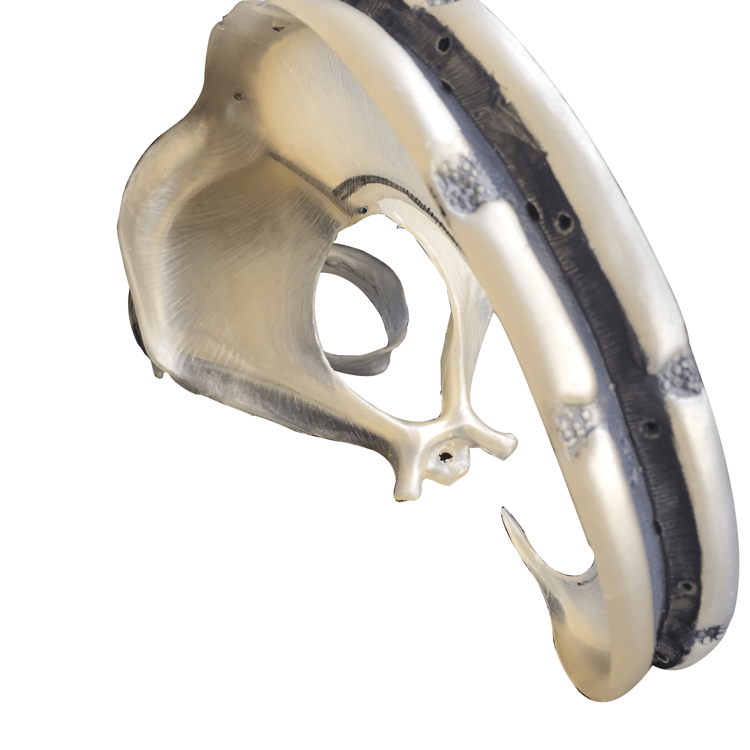 Udsnit af dura mater - eAnatomi