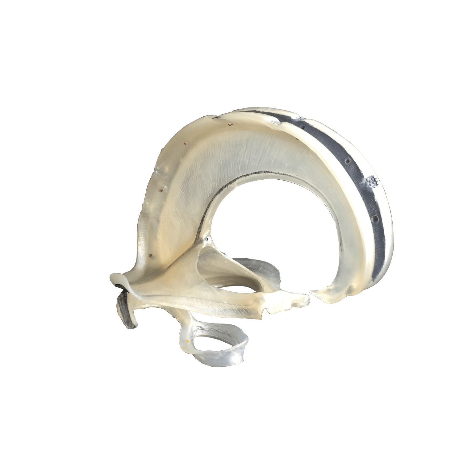 Udsnit af dura mater - eAnatomi