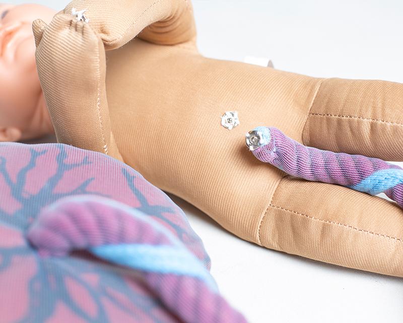 Fosterdukke m. moderkage og dens hinder og navlestreng - eAnatomi